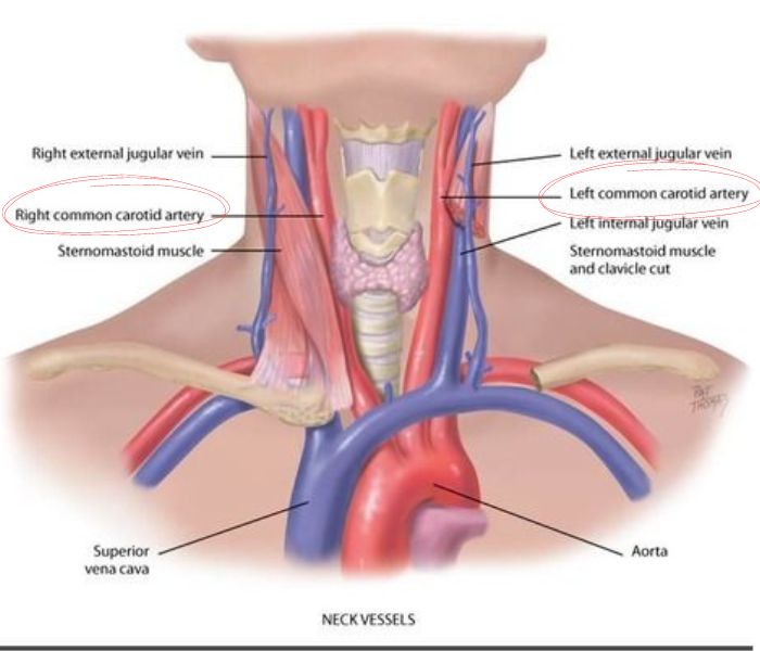 경동맥 초음파